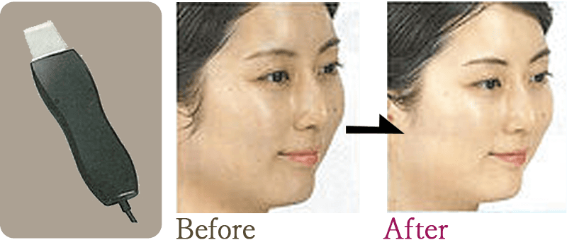 [スクライバー]ディープクレンジング